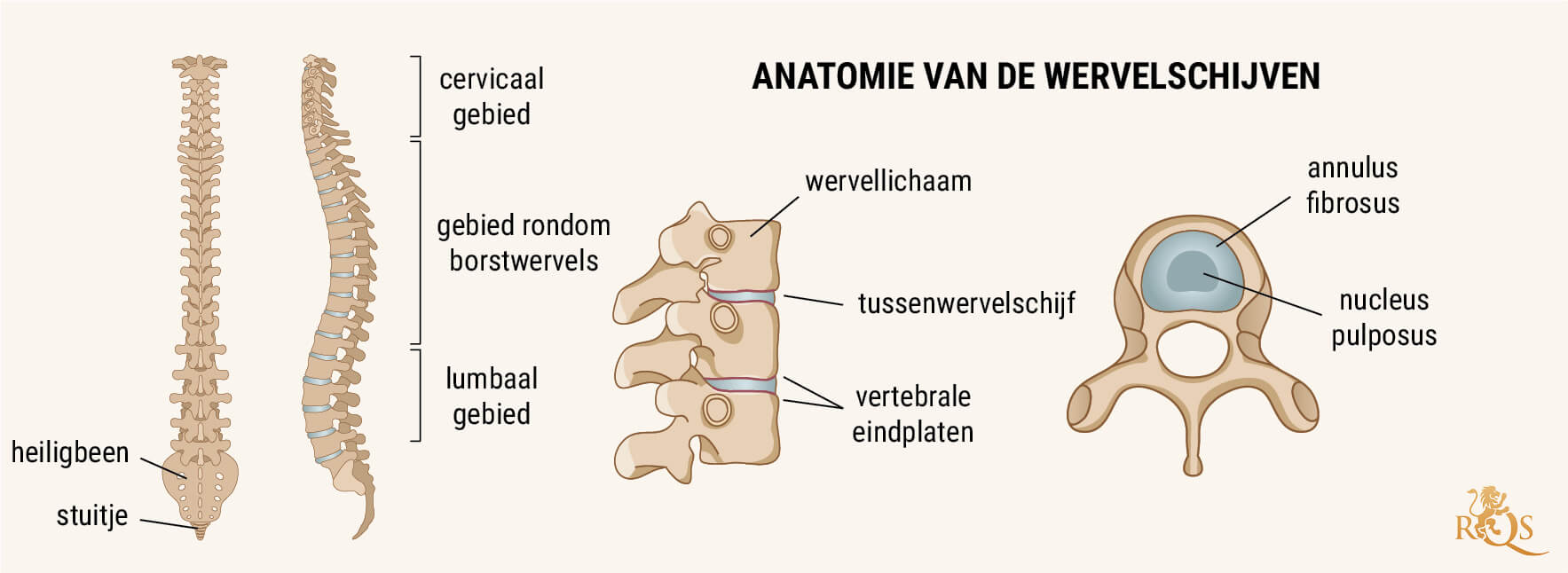 Wat Is Degeneratieve Schijfziekte? Wat Is Degeneratieve Schijfziekte?