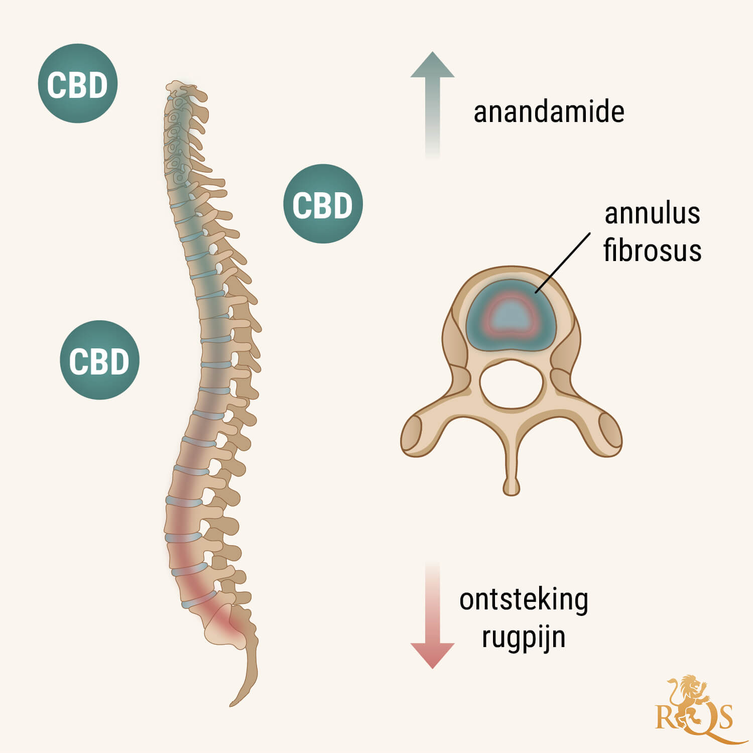 Hoe Helpt CBD bij Degeneratieve Schijfziekte? Hoe Helpt CBD bij Degeneratieve Schijfziekte?