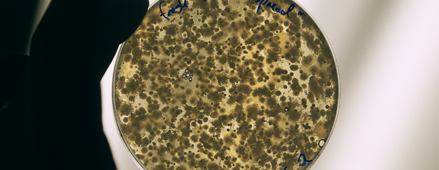 Planten En Microben: Een Symbiotische Alliantie