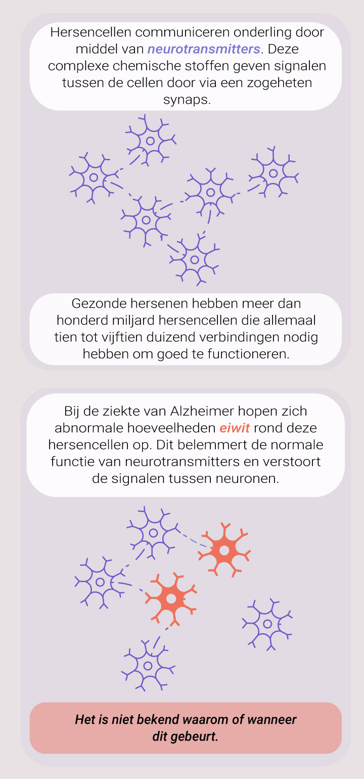 What Causes Alzheimer