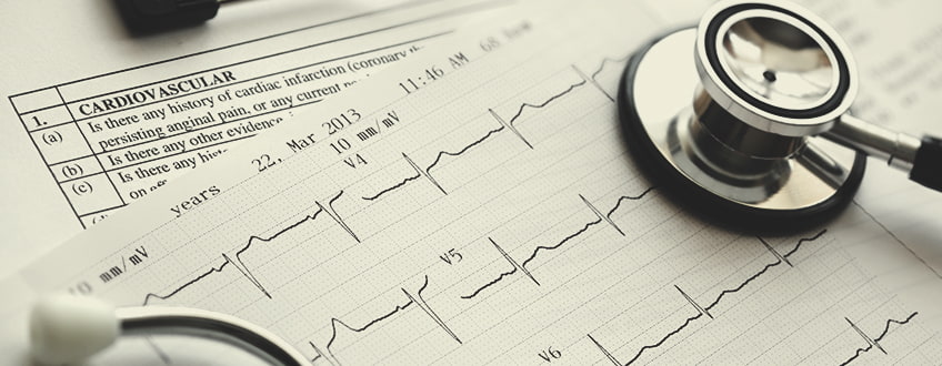 CBD en de cardiovasculaire gezondheid CBD en de cardiovasculaire gezondheid