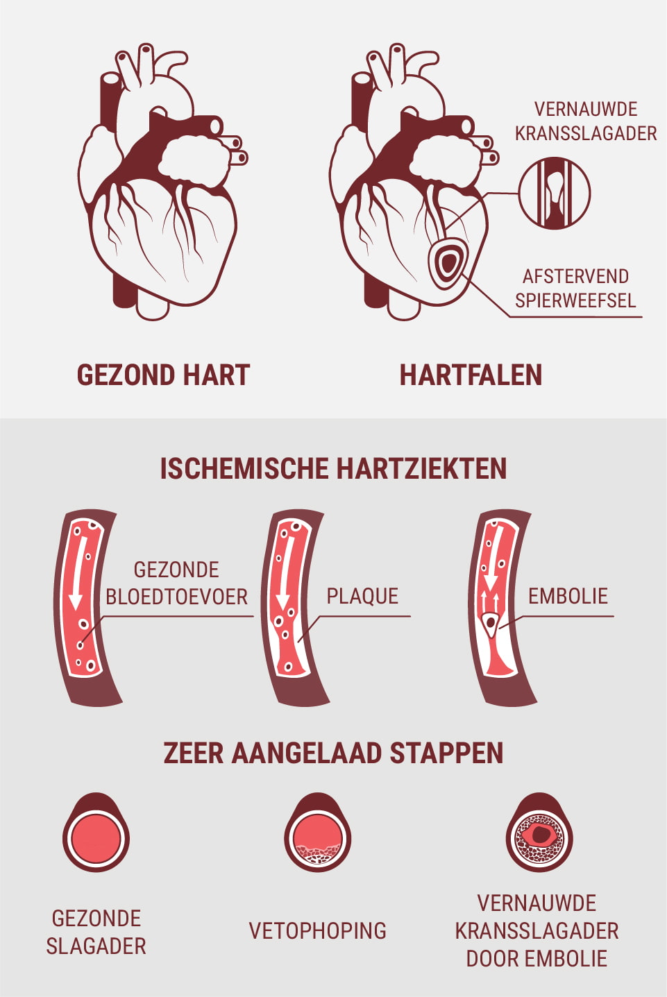 Zijn hart- en vaatziekten en hartziekten hetzelfde? Zijn hart- en vaatziekten en hartziekten hetzelfde?