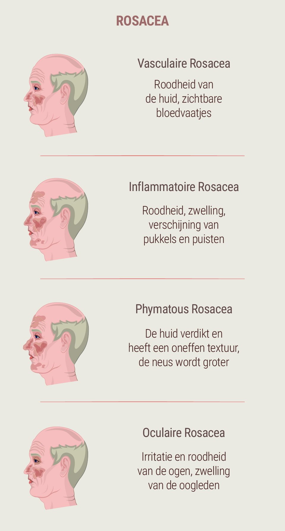 Wat is rosacea?