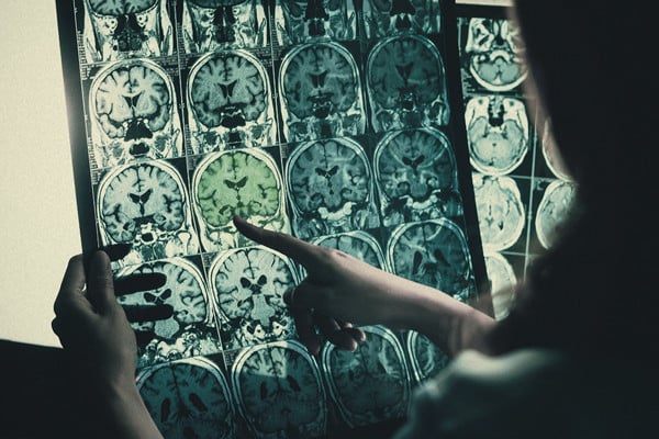 Is cannabis effectief voor mensen met een beperking?