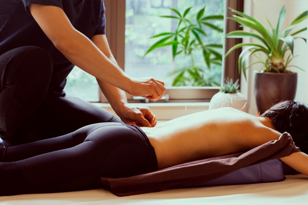 Cannabis en acupunctuur: Een dubbele boost voor het endocannabinoïde systeem