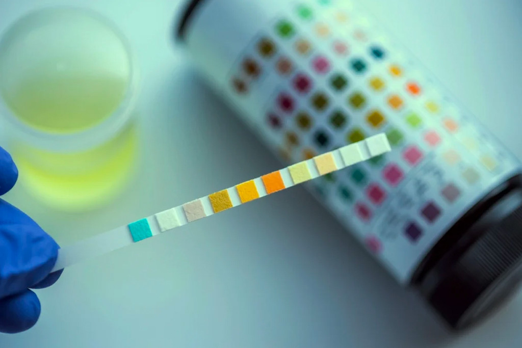 Kan CBD Zorgen Voor Een Positieve Drugstest?